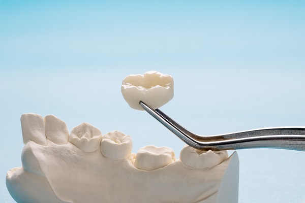 Dental Crowns &#    ; How To Identify When Something Is Wrong