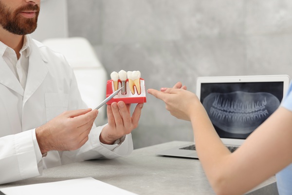 Dental Crowns: Common Issues And How To Address Them