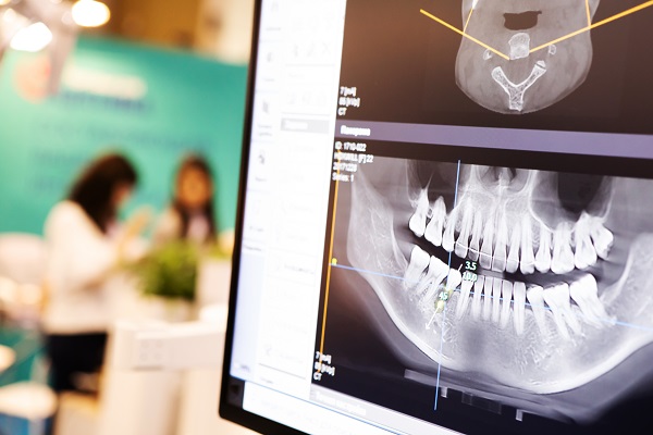 Does A Dental Exam Check For Gum Disease?