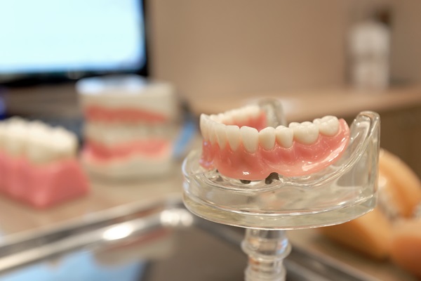 How Many Implants Are Needed For Lower Implant Supported Dentures?