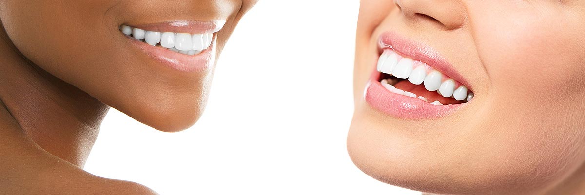 El Dorado Hills Teeth Whitening