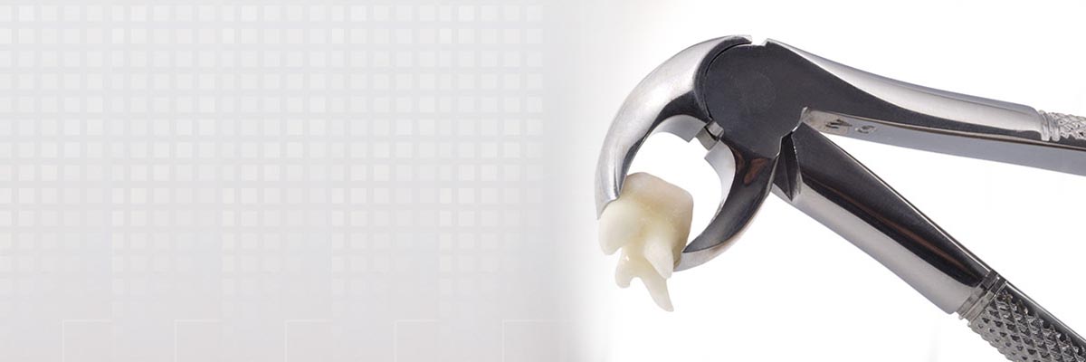 El Dorado Hills Tooth Extraction